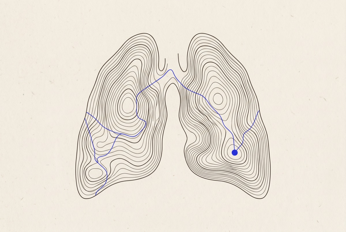 Topographic map of the KRAS G12C oncology landscape